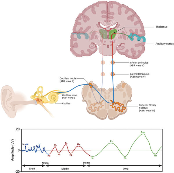 Somatosensory evoked potentials wiki