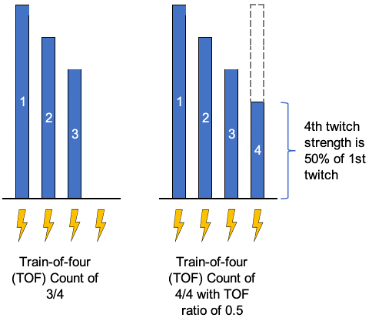 Train of Four - Peripheral Nerve Stimulation 