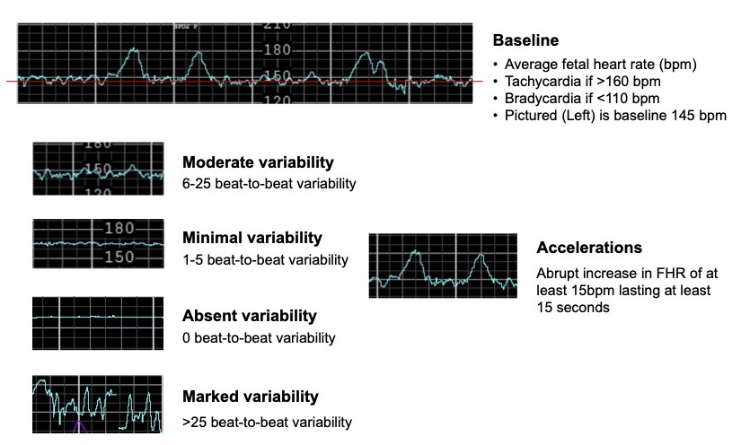 TGA considers banning fetal heart monitors