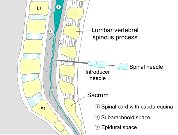 Vertebral column - Wikipedia