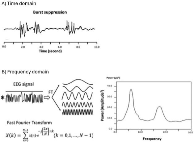 eeg 2012年 eeg 2012年